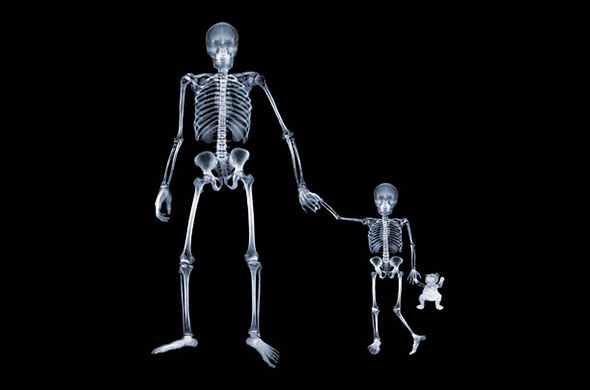 Kibri Yüzünden X-Ray`e Takıldı